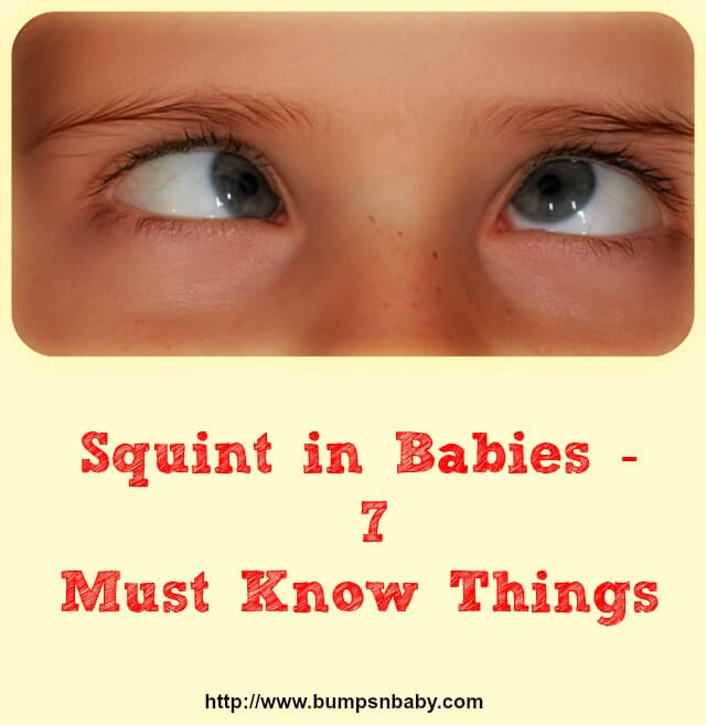 squint in babies