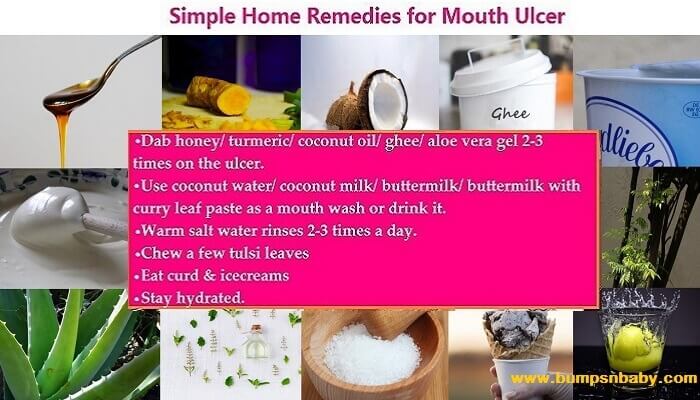 home remedies for mouth ulcer in babies and kids